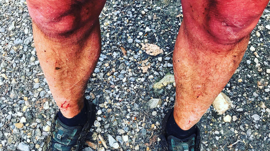 Les jambes de Pat Godin après 30 miles au Peak Bloodroot Ultra - Photo : Patrice Godin