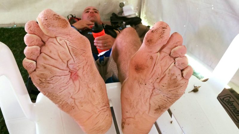 pieds en mauvais état